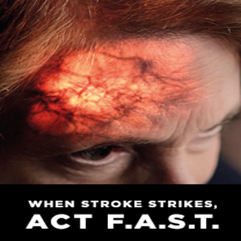 When Stroke strikes, Act F.A.S.T.